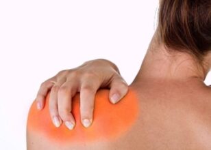 Синдром на Смрзнато рамо