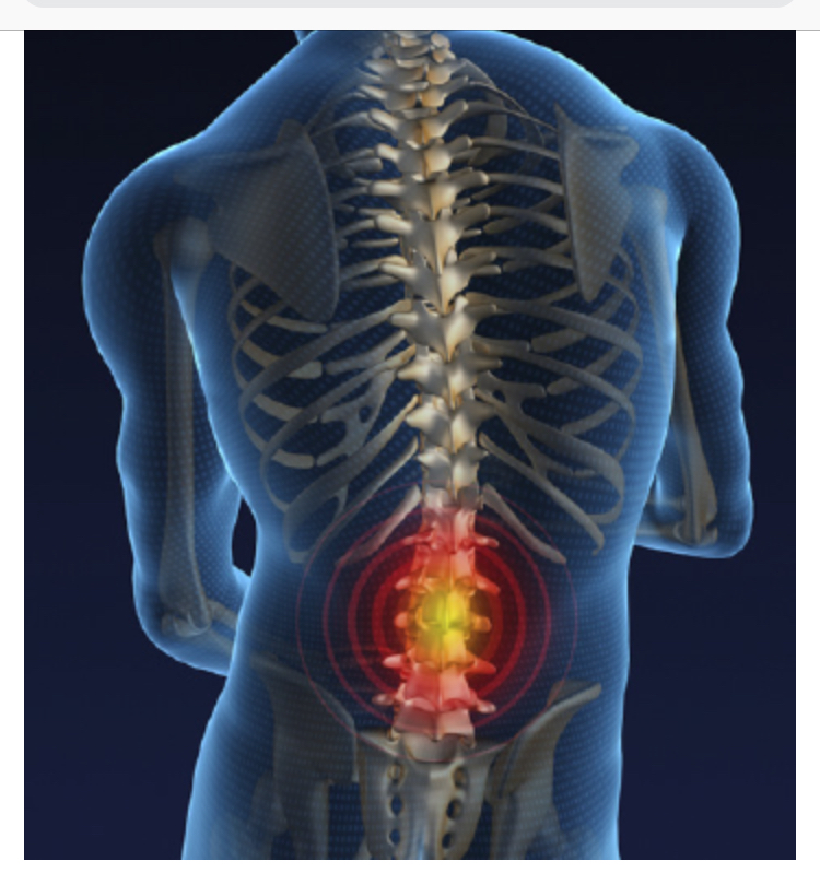 Акутна болка во долниот дел на грбот(половината)