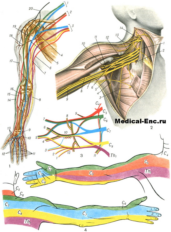 Породилна повреда на plexus brachialis кај деца – физиотерапија