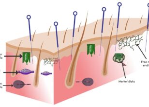 Третман со акупунктурни игли – Dry needling