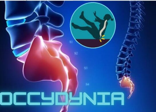 Физиотерапевтски третман на кокцидинија – coccydynia treatment