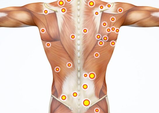 Третман со Масажа на Тригер Точки – Trigger point massage