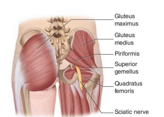 Пириформис синдром