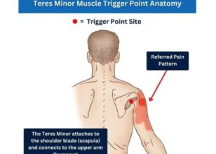 Терес минор мускул /Teres minor muscle