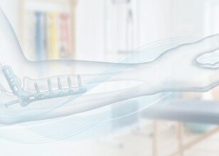 Отстранување на метални импланти (хардвер)