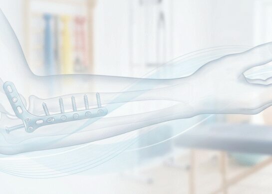 Отстранување на метални импланти (хардвер)