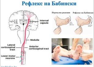 Бабински рефлекс – значење, тестирање и клиничка важност