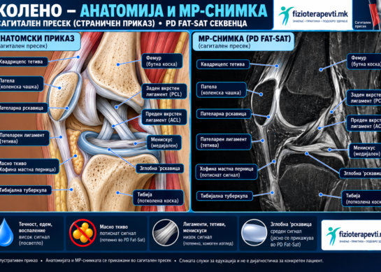Колено – анатомија, МР и РТГ снимки: Водич за пациенти и физиотерапевти